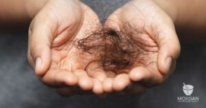 Hair Loss in GA Men & Women: Compounded Minoxidil, Finasteride, Tretinoin, Biotin, & More: Georgia Expert Insights