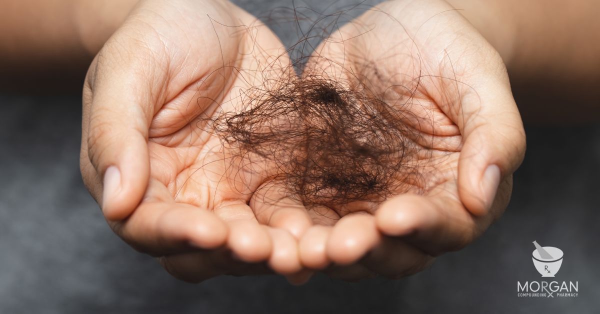 Hair Loss in GA Men & Women: Compounded Minoxidil, Finasteride, Tretinoin, Biotin, & More: Georgia Expert Insights