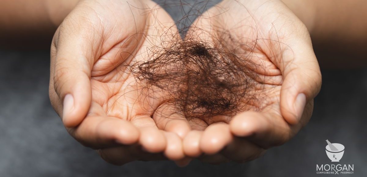 Hair Loss in GA Men & Women: Compounded Minoxidil, Finasteride, Tretinoin, Biotin, & More: Georgia Expert Insights